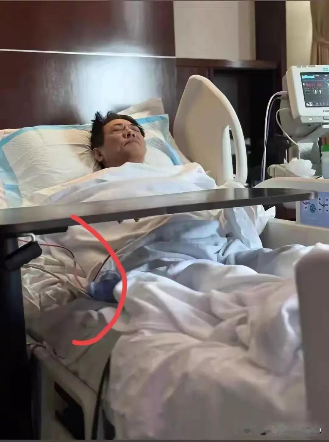 才62岁的新加坡华人功夫巨星李连杰没想到已经病入膏肓。据说已经安排后事了。真的让