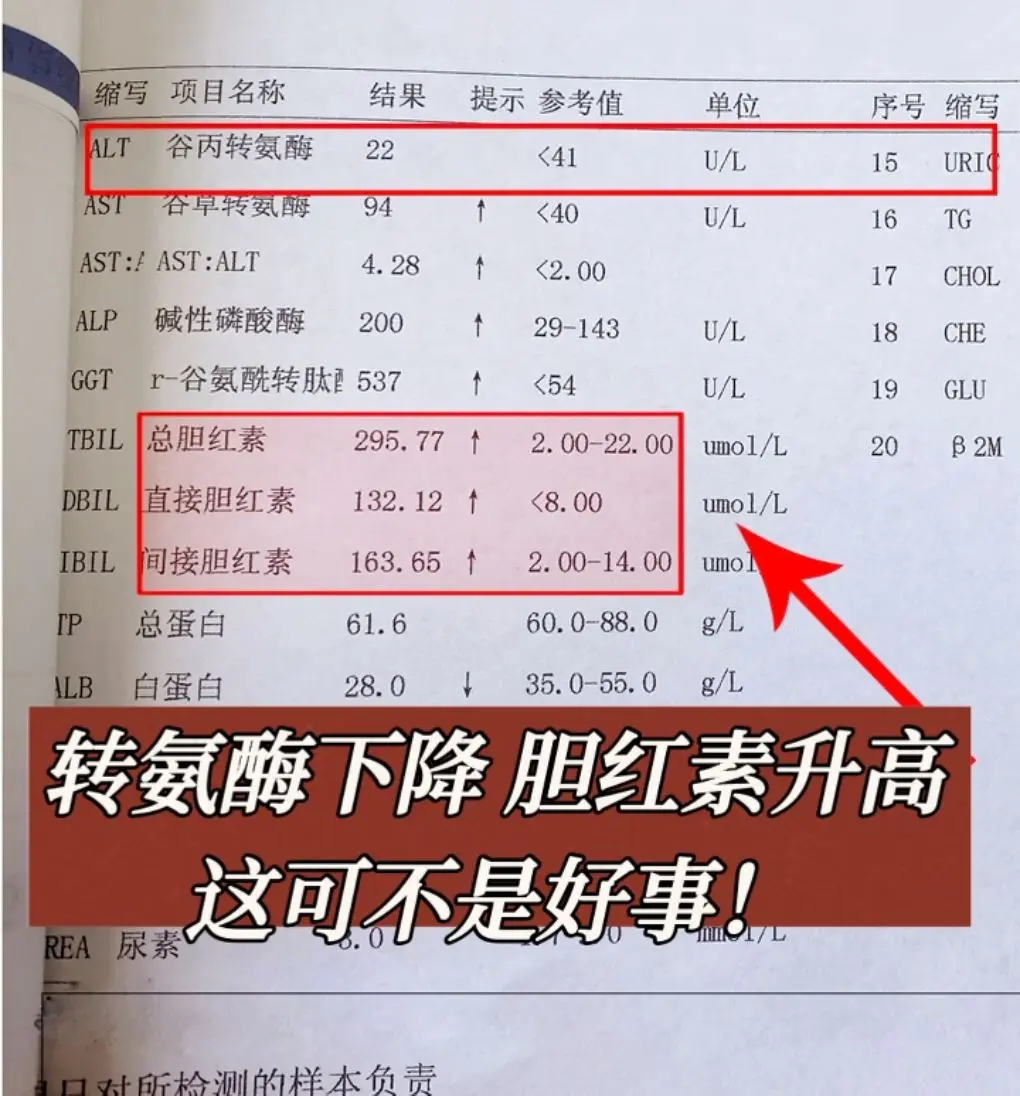 转氨酶下降，胆红素升高，没有那么简单！我这个河北的患者，当时来的时候...