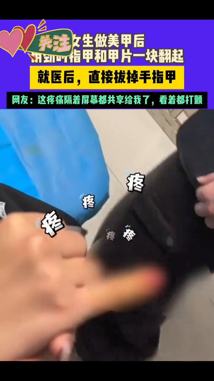 女生做美甲后，指甲和甲片一块翻起，就医后直接拔掉手指甲。
网友：这疼痛隔着屏幕都