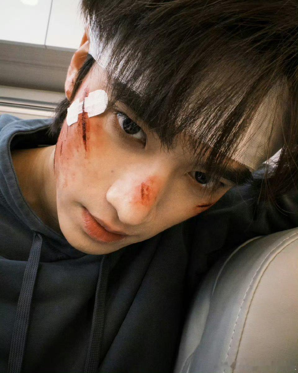 张康乐今天战损营业 ​​​好像在哥哥的鼻梁上滑滑梯[打call][打call][