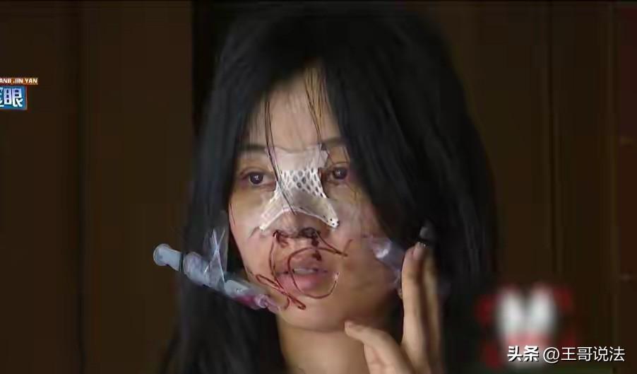 浙江杭州，一女子右手长了血管瘤，治疗费20多万，女子为了赚钱，到KTV应聘，对方