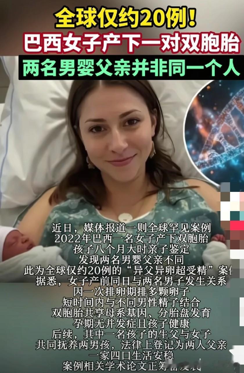 世界之大无奇不有啊，巴西惊现“异父异卵超受精”双胞胎，意思一女子同一天和两个男人