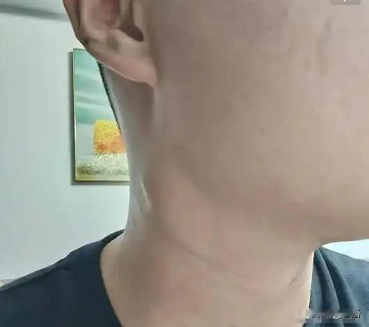 再年轻也没用！江西23岁徐平安去世，死因曝光，源头竟是一颗痣
世事无常！

近日