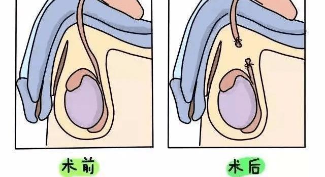 #健康真探社#【如果不避孕，女性一生能生多少个孩子？】当代的年轻人面临着巨大的经