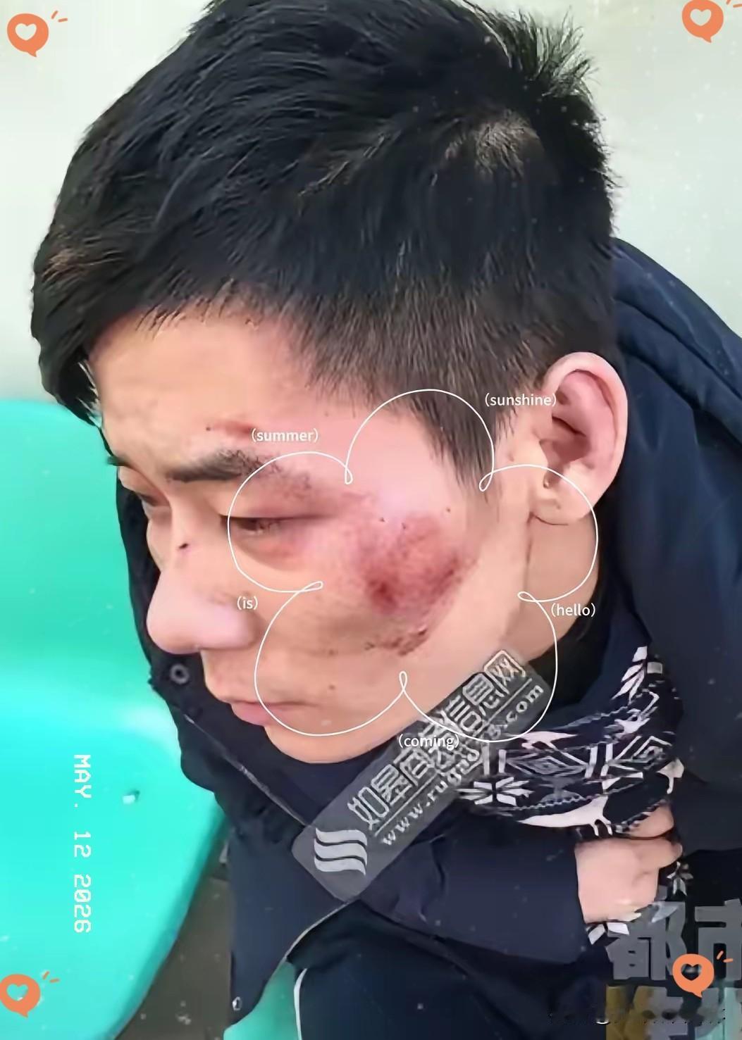 大半夜被人追打，直接往武警营门跑。
​这哥们儿算是把“绝境求生”玩明白了。
​5