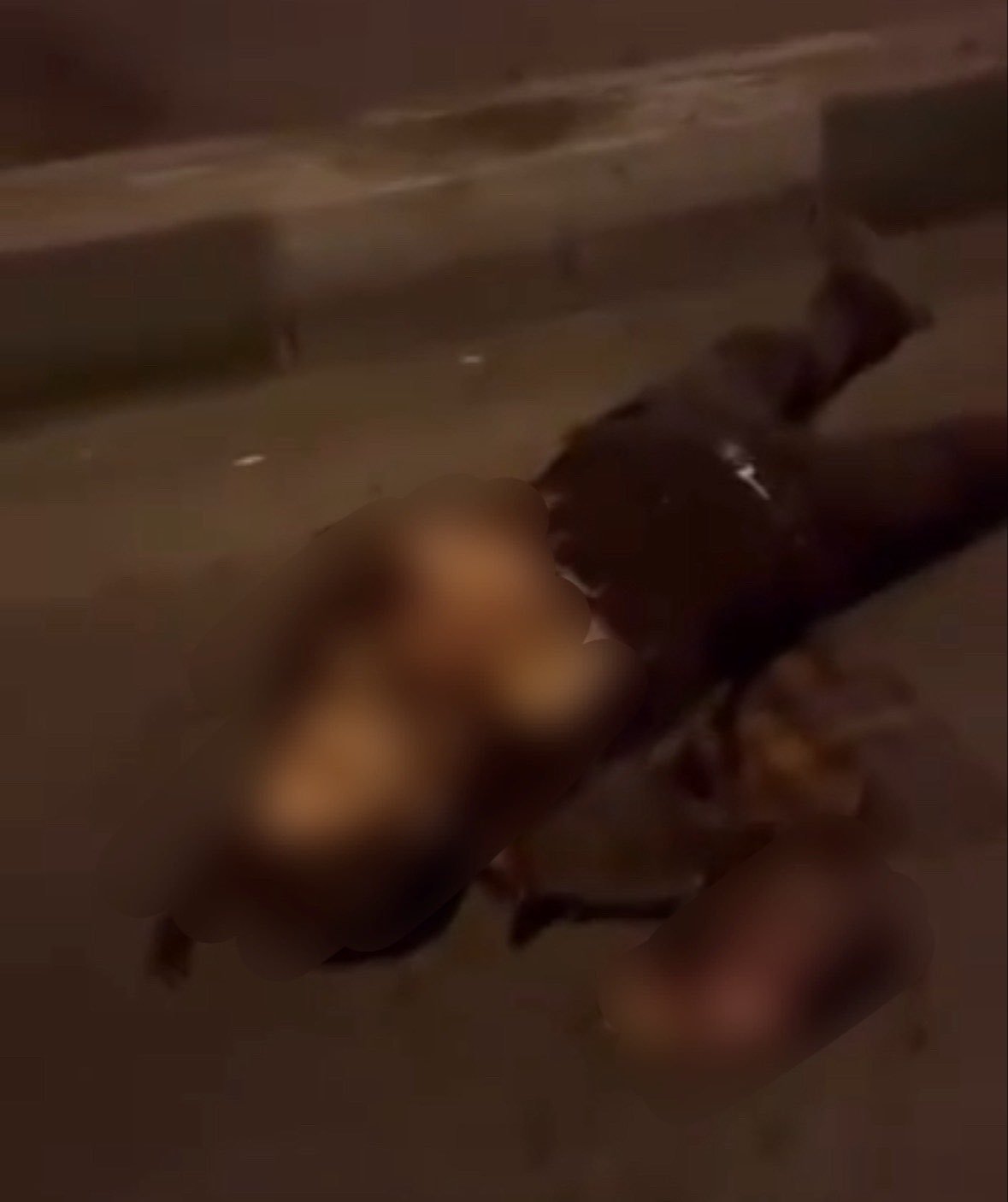 🇮🇷❗一名手持自制手榴弹的武装分子因手榴弹未及投掷便提前引爆，被炸断手掌。事