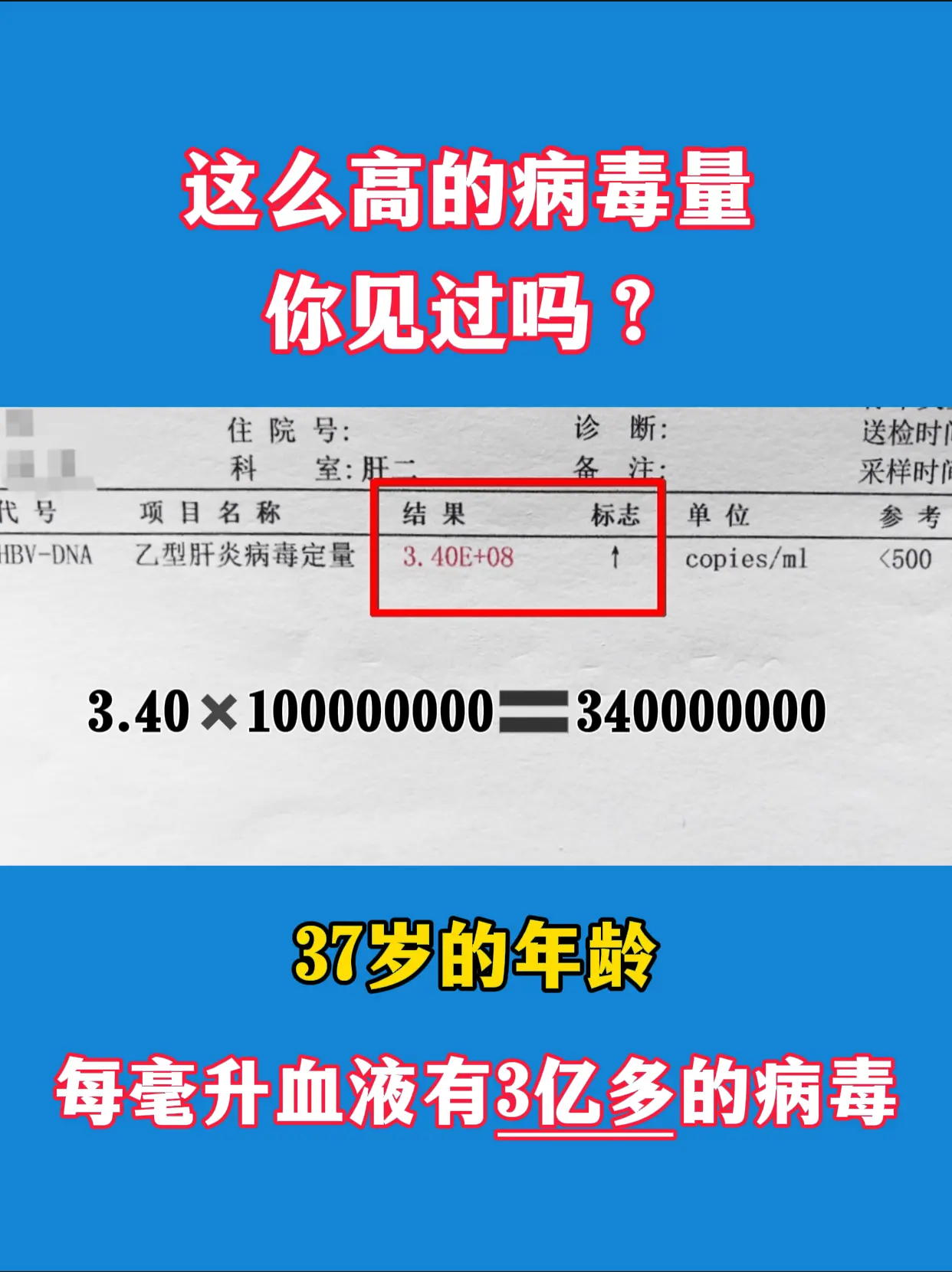 这么高的病毒量你见过吗？。大家看这位患者的检查单，是一位山东菏泽的朋友...
