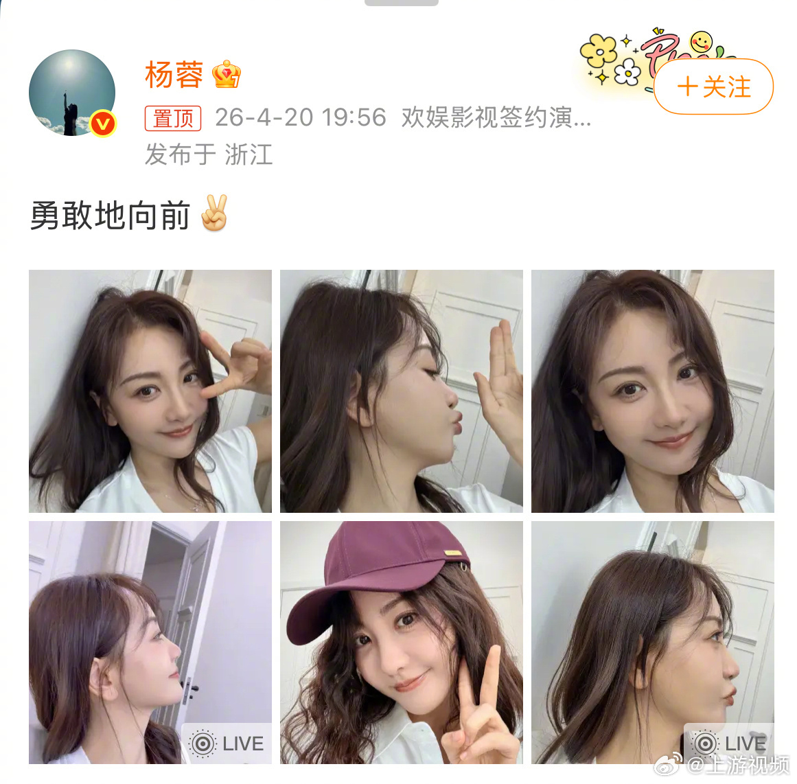 【#杨蓉烫伤恢复后晒近照#】#杨蓉晒照发文鼓励自己勇敢前行#4月18日，据潇湘晨