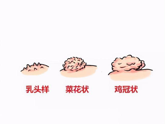 【患者提问】我和我的爱人闪婚，婚后才发现我的爱人睡觉时总喜欢摸我下面，这几天我发