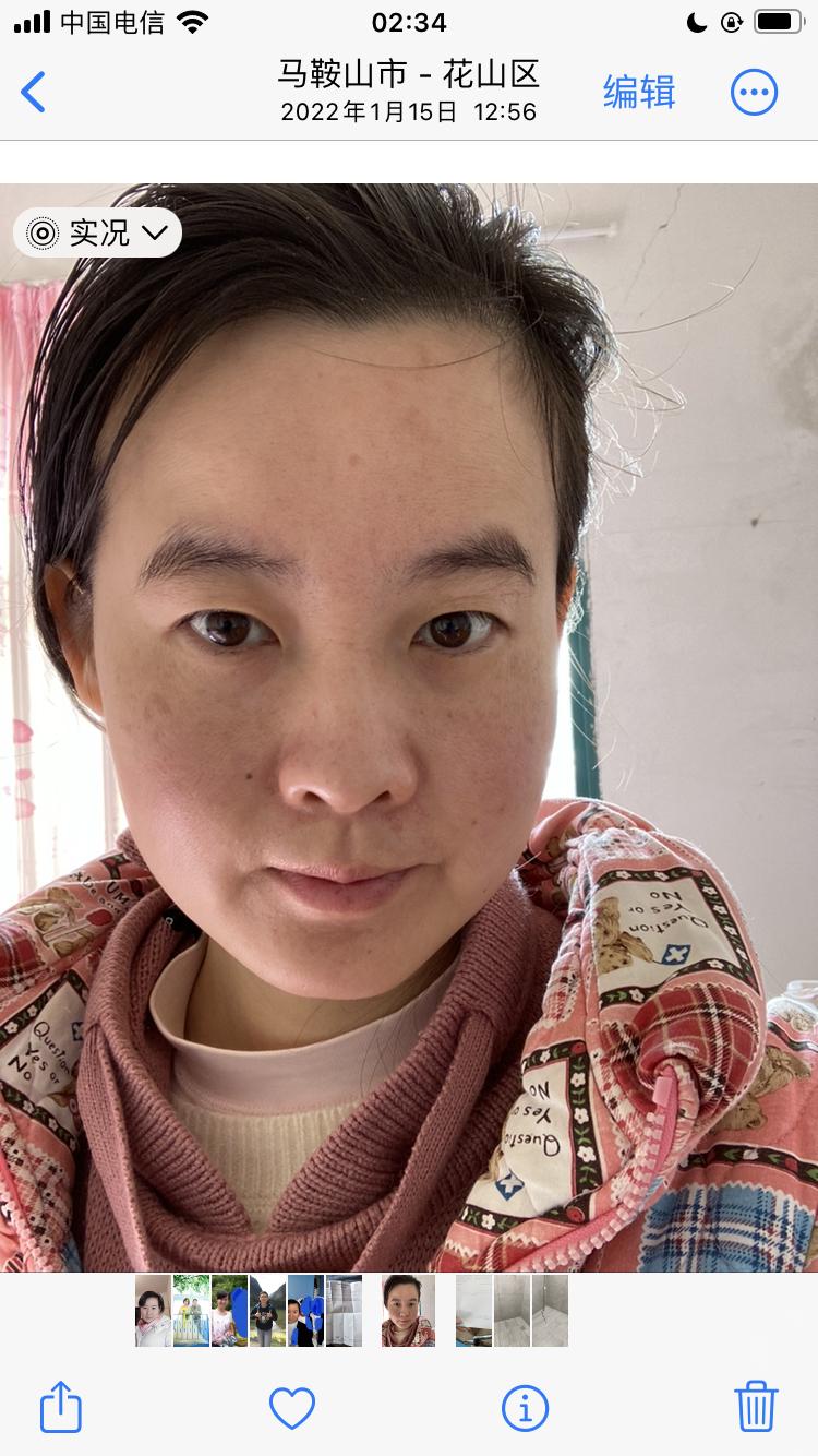 发两张清晰图片，斑块面积越来越大，说明疾病越拖越严重，其他未治疗的疾病同样越拖越