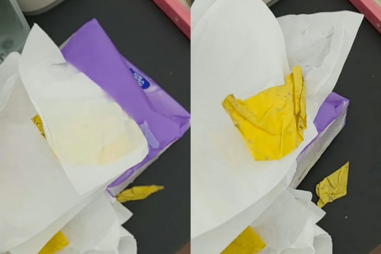 维达抽纸被曝有黄色不明物体这么大的品牌，不应该呀！用了好多年的维达抽纸，这心里得