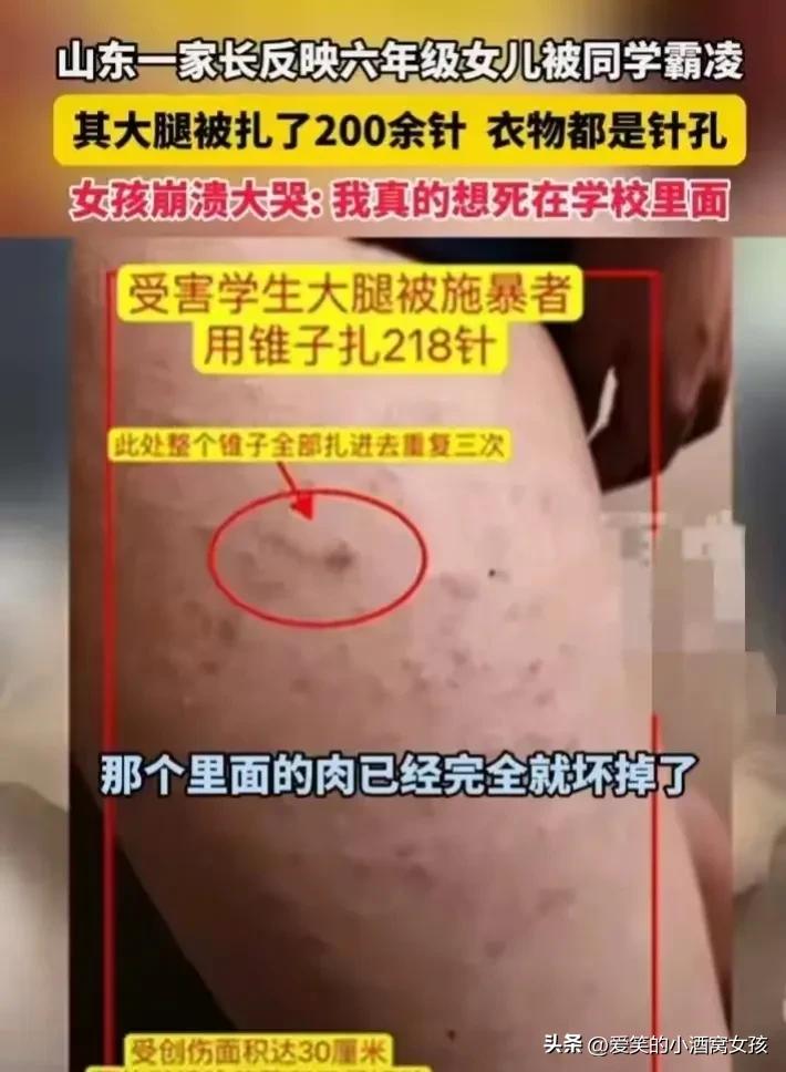 我一点不同情山东这个女生。被男生用铁锥扎了200多下。就那么忍着？真让人不能理解