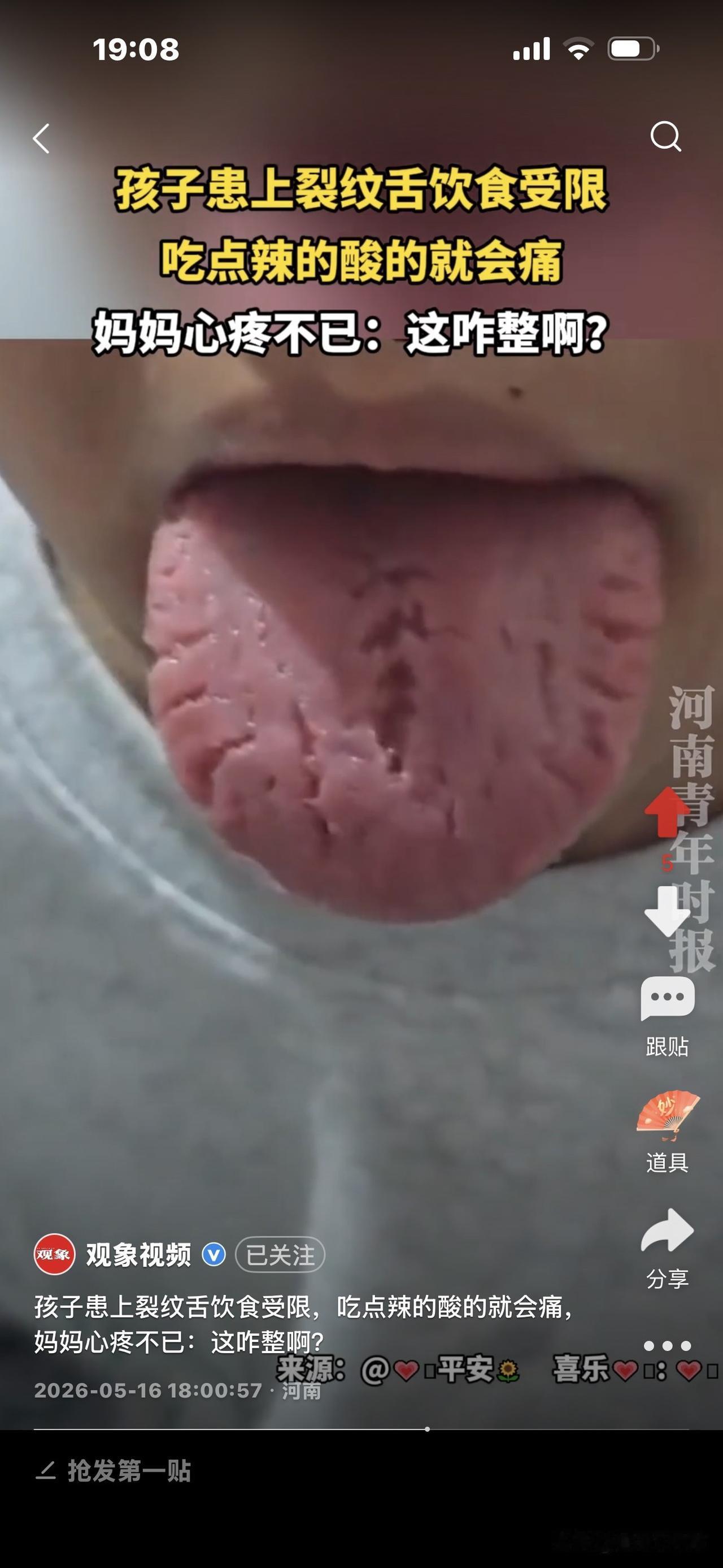 这舌头好吓人，满是裂纹。
这是一个孩子的舌头，
妈妈说，孩子吃点辣的酸的都会痛，