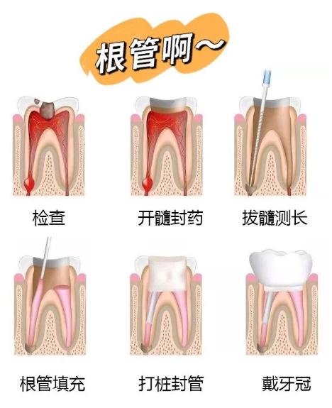 持续牙疼，但是吃甲硝锉能缓解，那还要去看牙吗？

牙疼持续的话肯定不正常，说明有