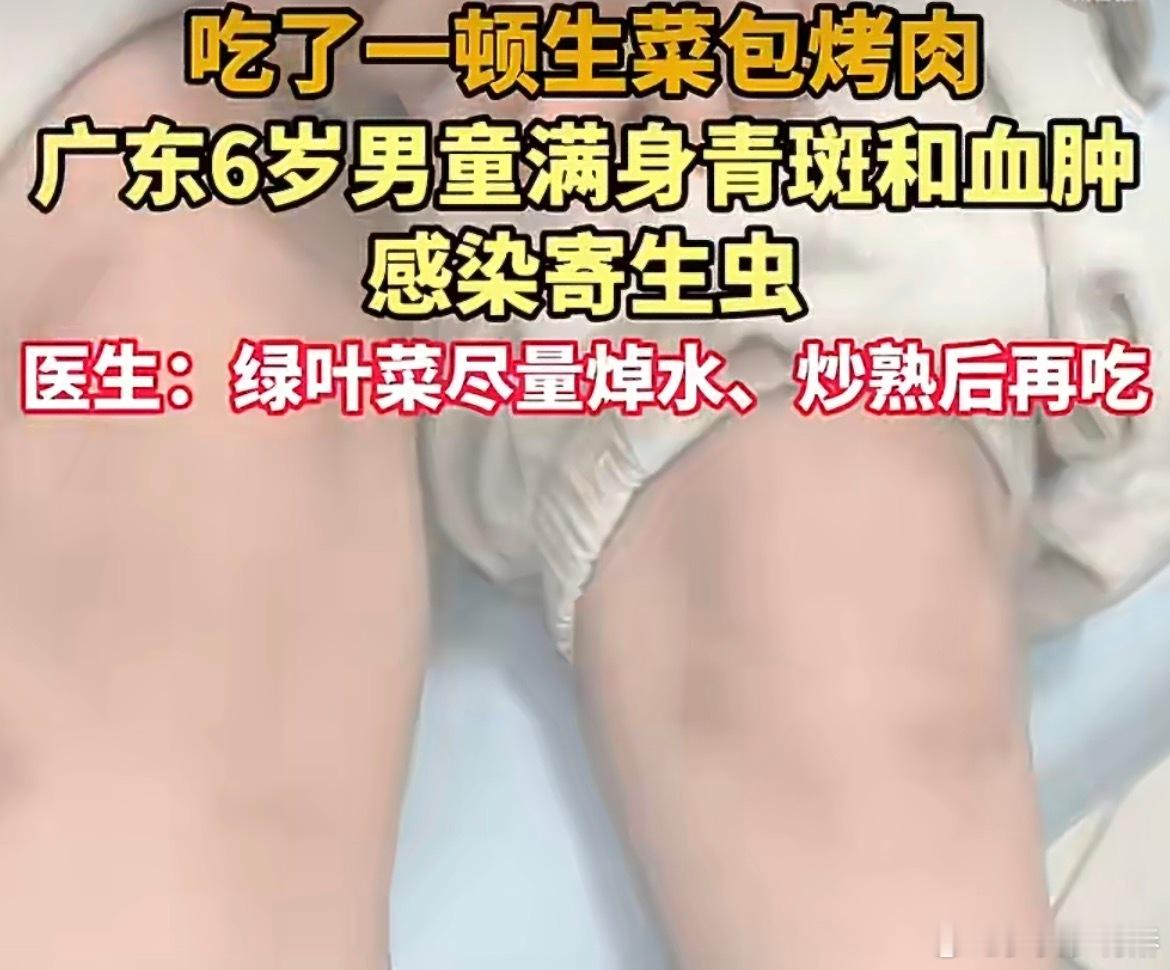 6岁男童吃生菜后血肿感染寄生虫别再拿“生吃更营养”当借口了，对孩子来说，生吃蔬菜