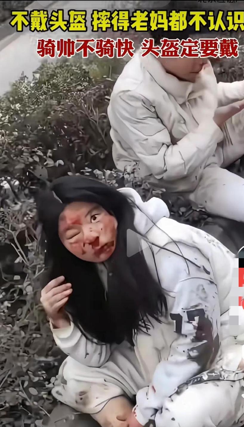 骑车不戴头盔，摔的面目全非，这个模样连自己亲妈都不认识了。