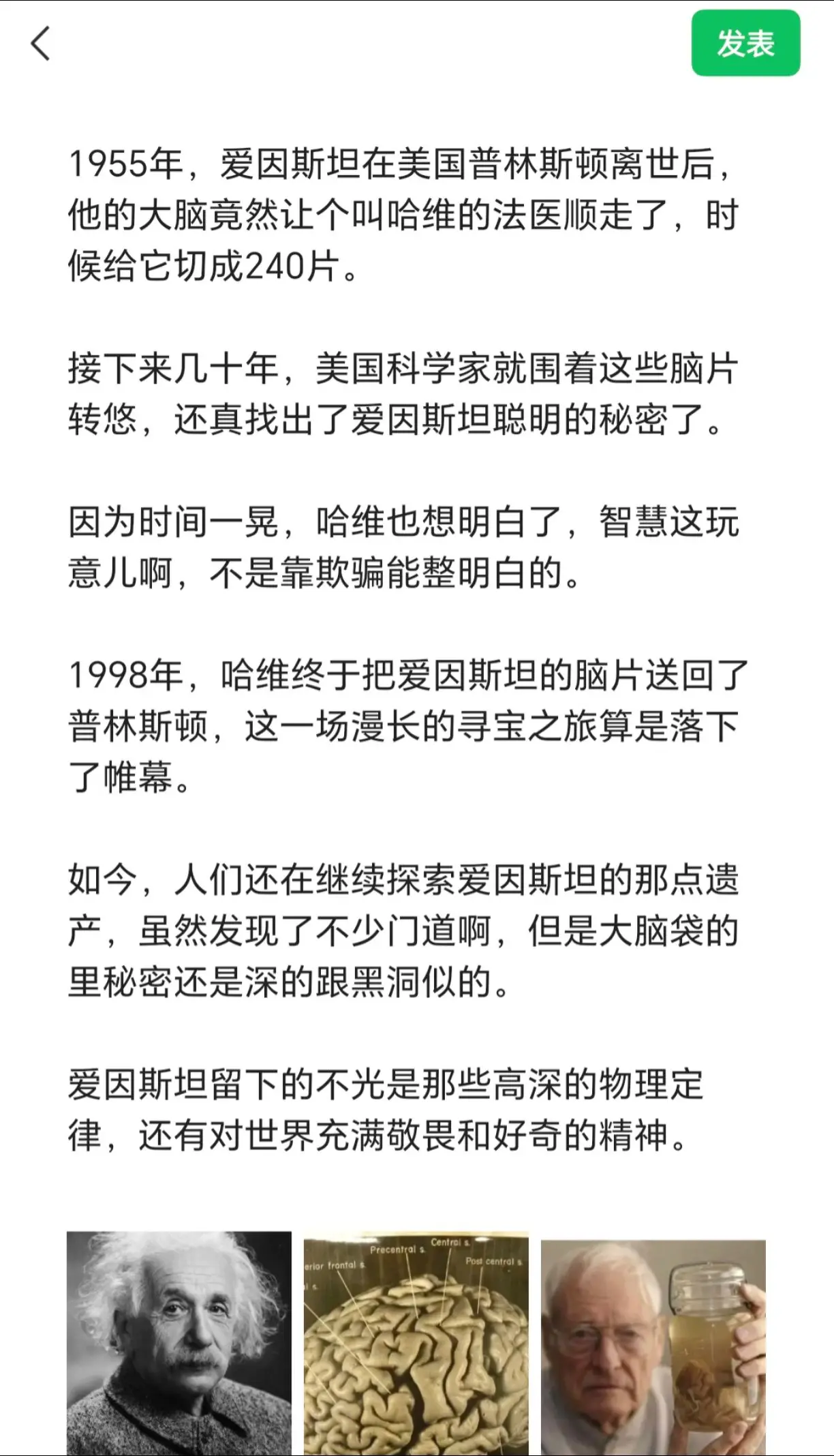 爱因斯坦的脑子被切成240片也没研出成果。1955年，爱因斯坦在美国普...