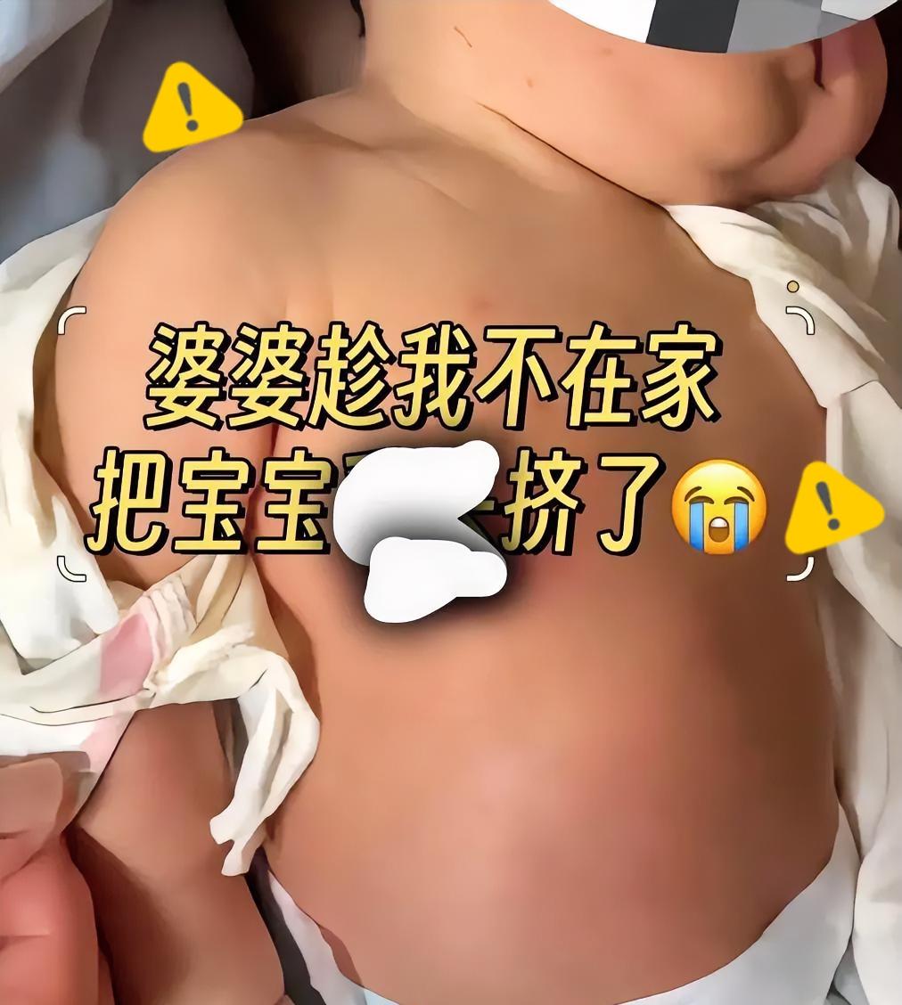 我真的要气哭了！

家里老人居然趁我不在，偷偷去挤刚出生没多久宝宝的乳头！
 