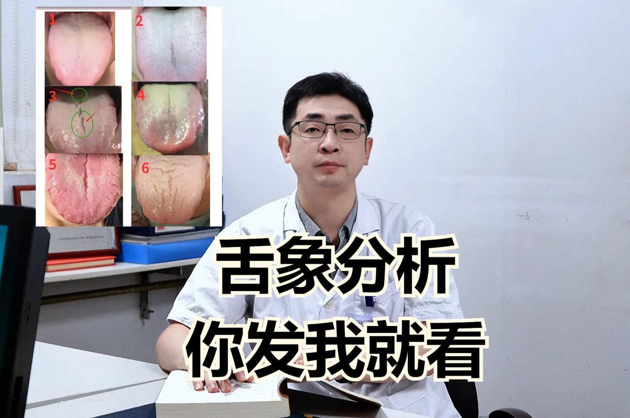 这个月每天坚持看舌象第11天！你发舌头，我来辨证！现场出结果！

不要想看一张小