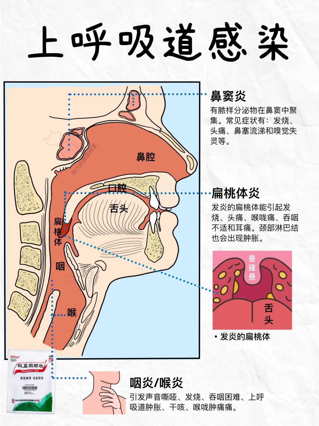 持续咽痛一定要警惕|拯救刀片嗓‼️
