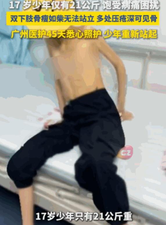 悲剧终究还是发生了！江西一名17岁少年，六年来频繁呕吐、几乎无法进食，身高150