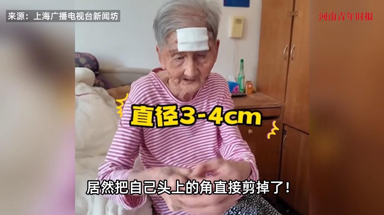 “活久见！”近日，上海，一98岁高龄的老太因为头上长了一个3公分的“犄角”，老太