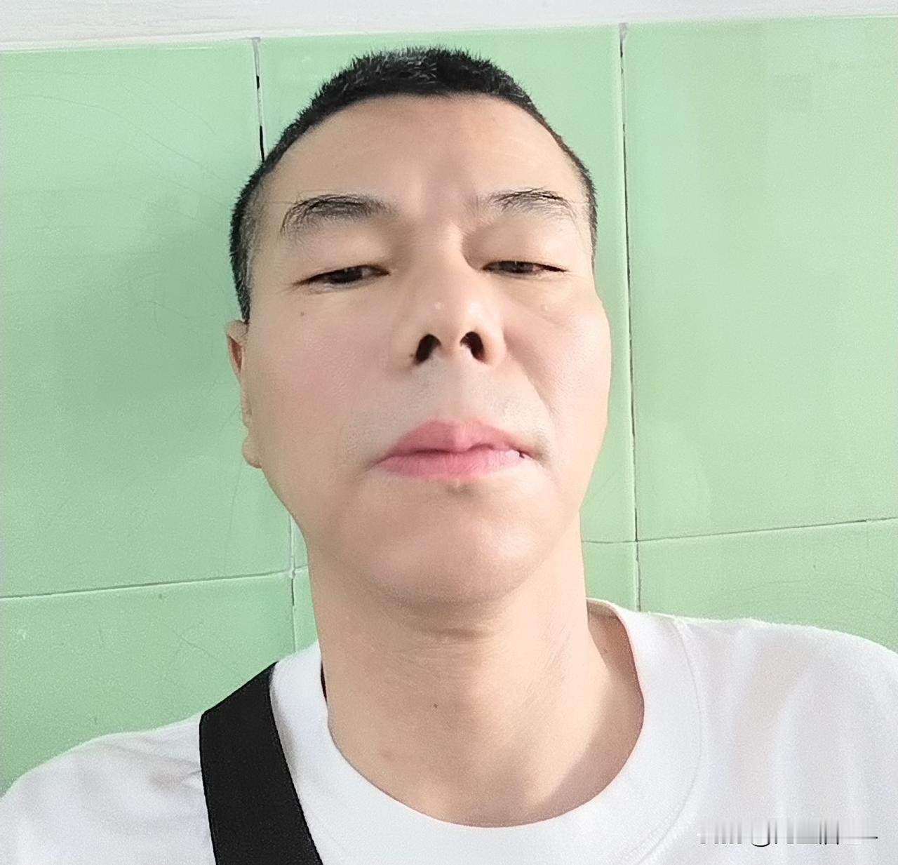 胃癌术后三年了，不再想太多！
8月23日，是胃癌术后整三年，这次检查结果总体还好