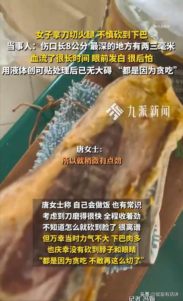 离谱又惊险！7月28日报道，北京，一女子居家切火腿时遭遇意外，本想好好的一顿加餐