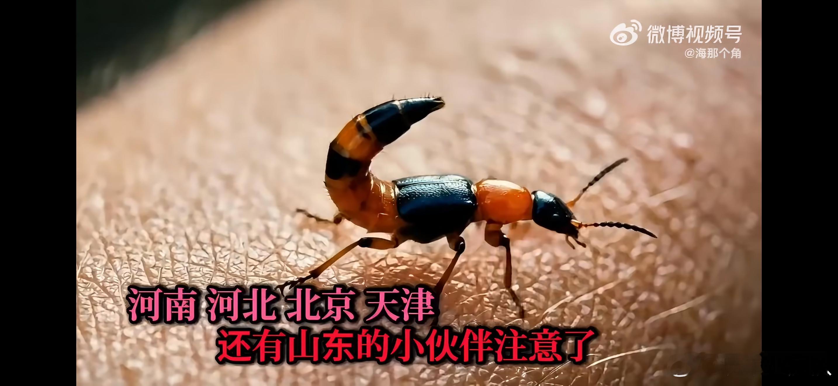 北方 隐翅虫我敲！还真是啊，昨天趴在窗户上，我妈老大声叫我了，说这就是那个硫酸虫