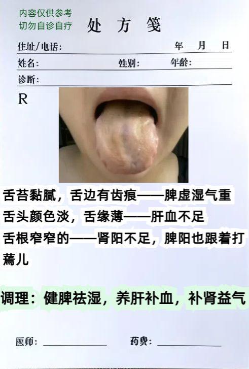 今天继续来看舌象！

大家可以给我发舌头照片，记得不要用美颜相机，不然容易辨证错