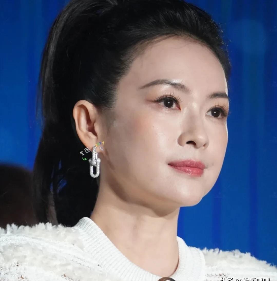 章子怡的脸“肿”对了。
苛责她脸肿的人，恰恰是逼得40+女演员必须用玻尿酸把年龄