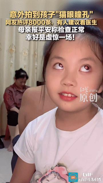 “简直不可思议！”湖南，一女子随手给女儿拍视频，竟然发现孩子的眼睛是“猫眼瞳孔”