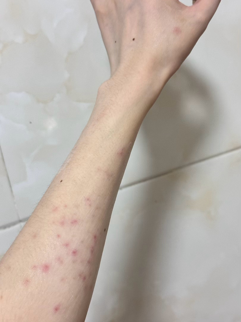 经过我的发现，我感觉过敏可能拍手臂试色是引导原因，拍的时候卸妆卸来先去，导致有一