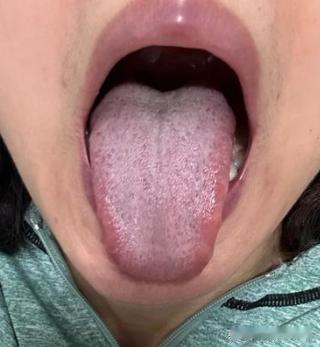 肝不通，易淤堵！送你两个中成药，先柴胡，再血府，打通全身淤堵
有一位粉丝可以说是