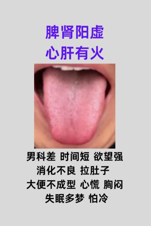 3 种舌象看透脾虚湿盛，辨证调理不踩坑