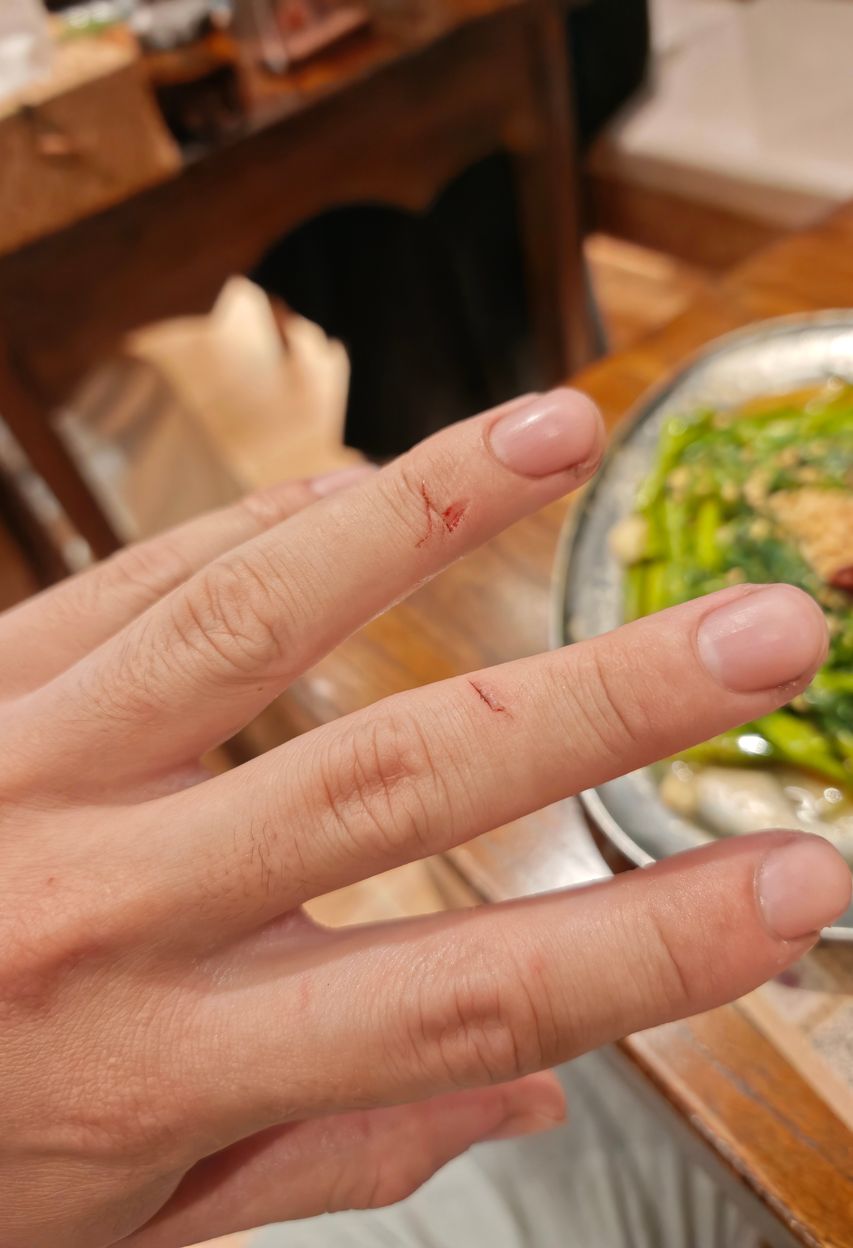 今天的活有点差池，被电锯给锯了 ​​​