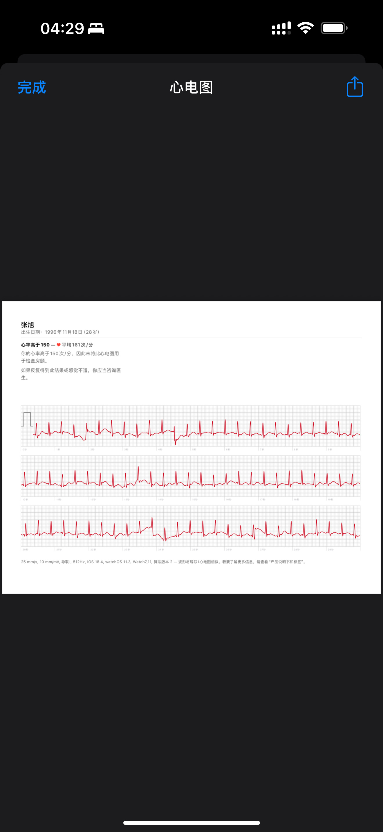 哎[淡淡的][淡淡的] ​​​