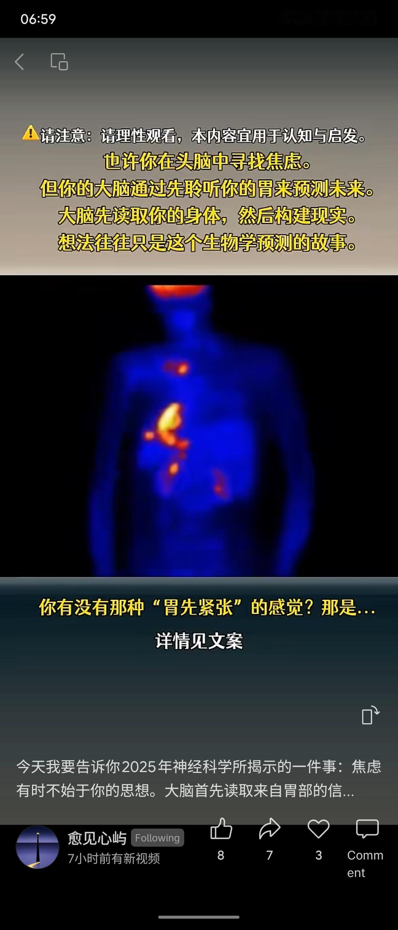 神经科学揭示：焦虑或不始于思想，而始于胃部信号。大脑先读取身体状态，再构建现实，