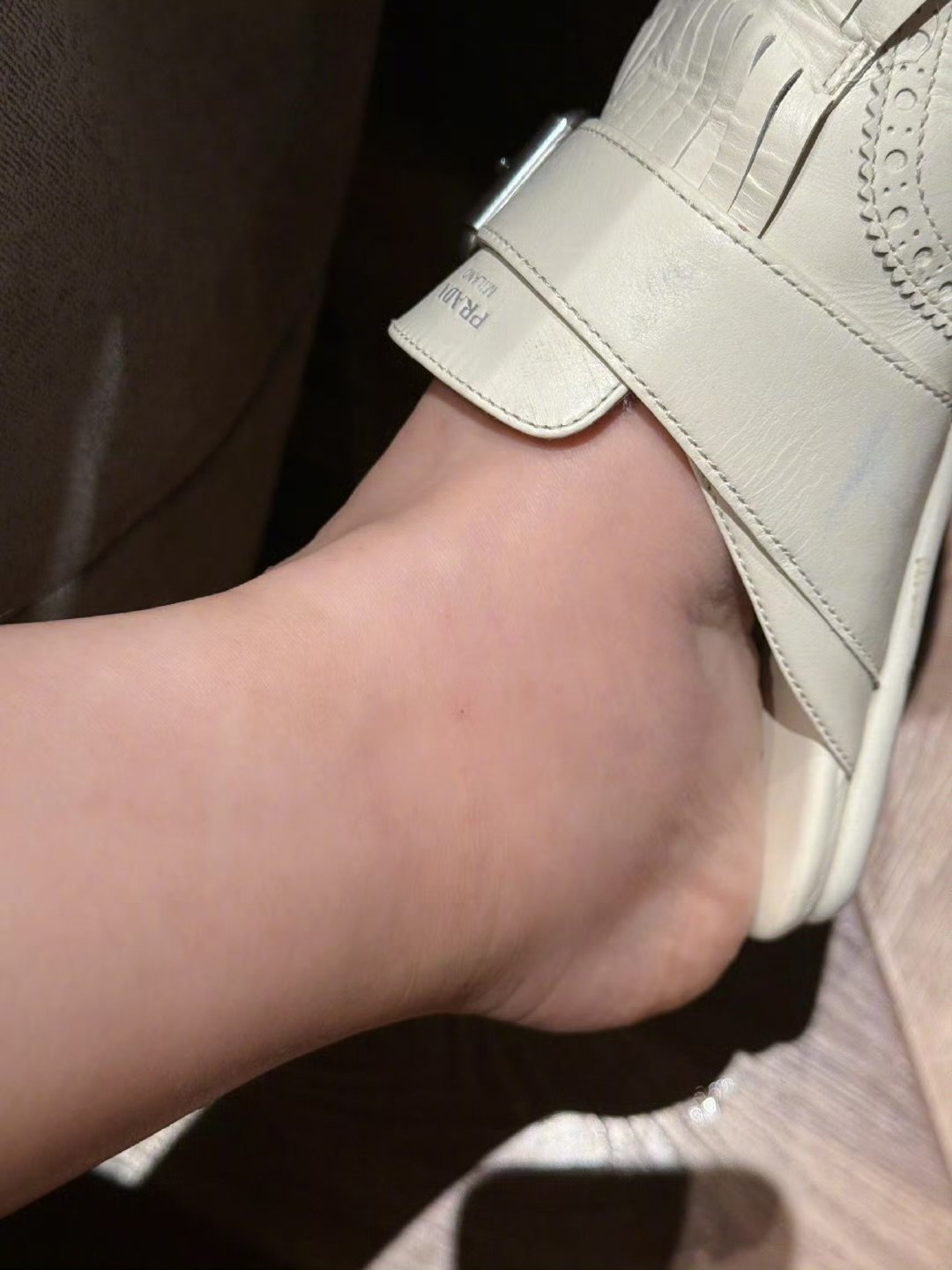 张馨予雨林徒步后脚肿成了猪蹄张馨予脚肿成猪蹄了张馨予脚肿成猪蹄了🐷娱乐[超话]