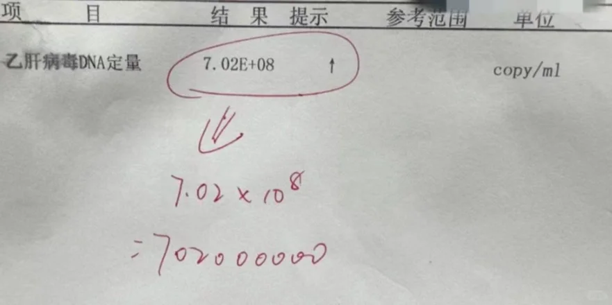 35岁患者，携带7亿多乙肝病毒，究竟还能活多久 乙肝影不影响寿命，携带...