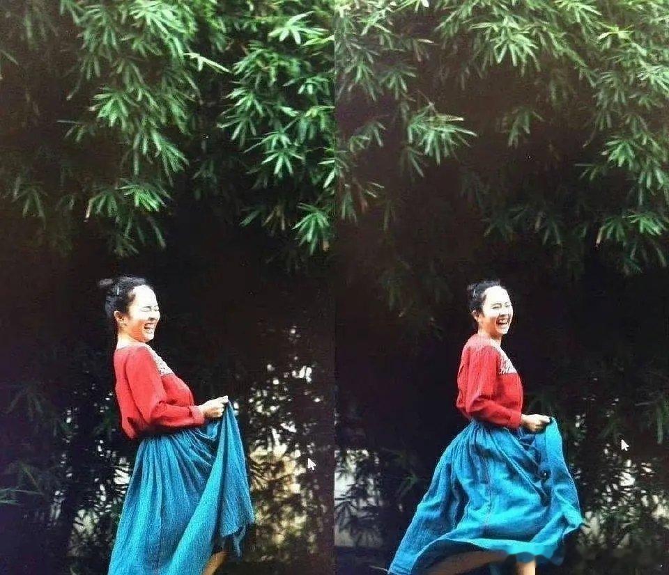 真的第一次见，难怪她的发型不管怎么做，前排都有小绒毛，原来是做了植发，缓解我的发