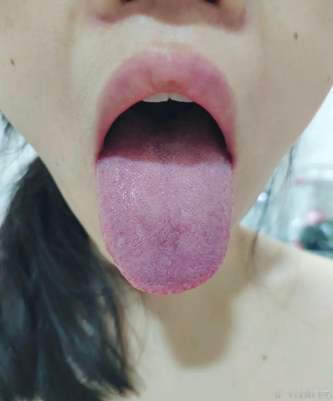 姐妹这是怎么了，看上去有点严重呀….[笑cry] 