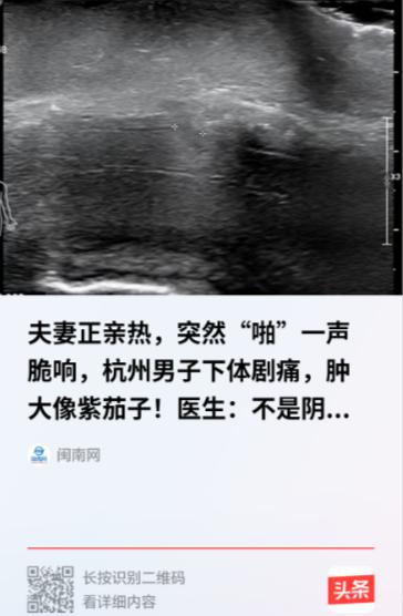 “光听着就疼！”浙江杭州，49岁的季先生和妻子亲热时动作猛了些，突然一声闷响，下