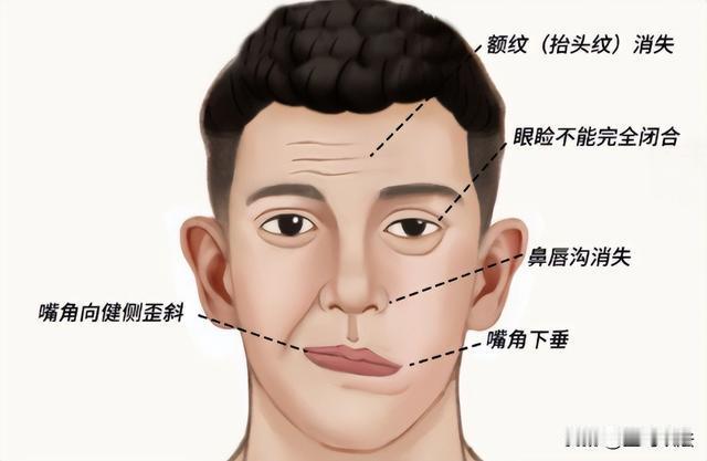 喝水老呛、杯子端不稳？别光怪年纪，脑子可能在求救！

喝水，谁不会？可要是回回呛