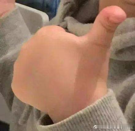 终于知道突然变丑的原因了 不用过度容貌焦虑，找到状态下滑的根源，慢慢调整就会好转