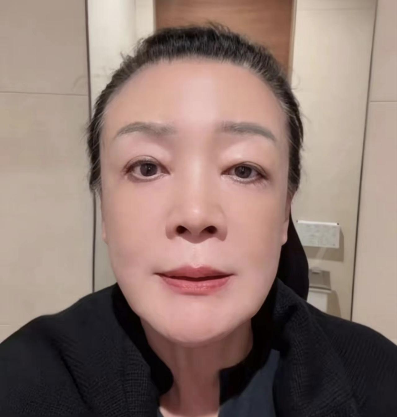 汪妈妈-兰姐的面相变了，其实她别画下眼线，感觉怪怪的！
可能是因为患白癜风的缘故