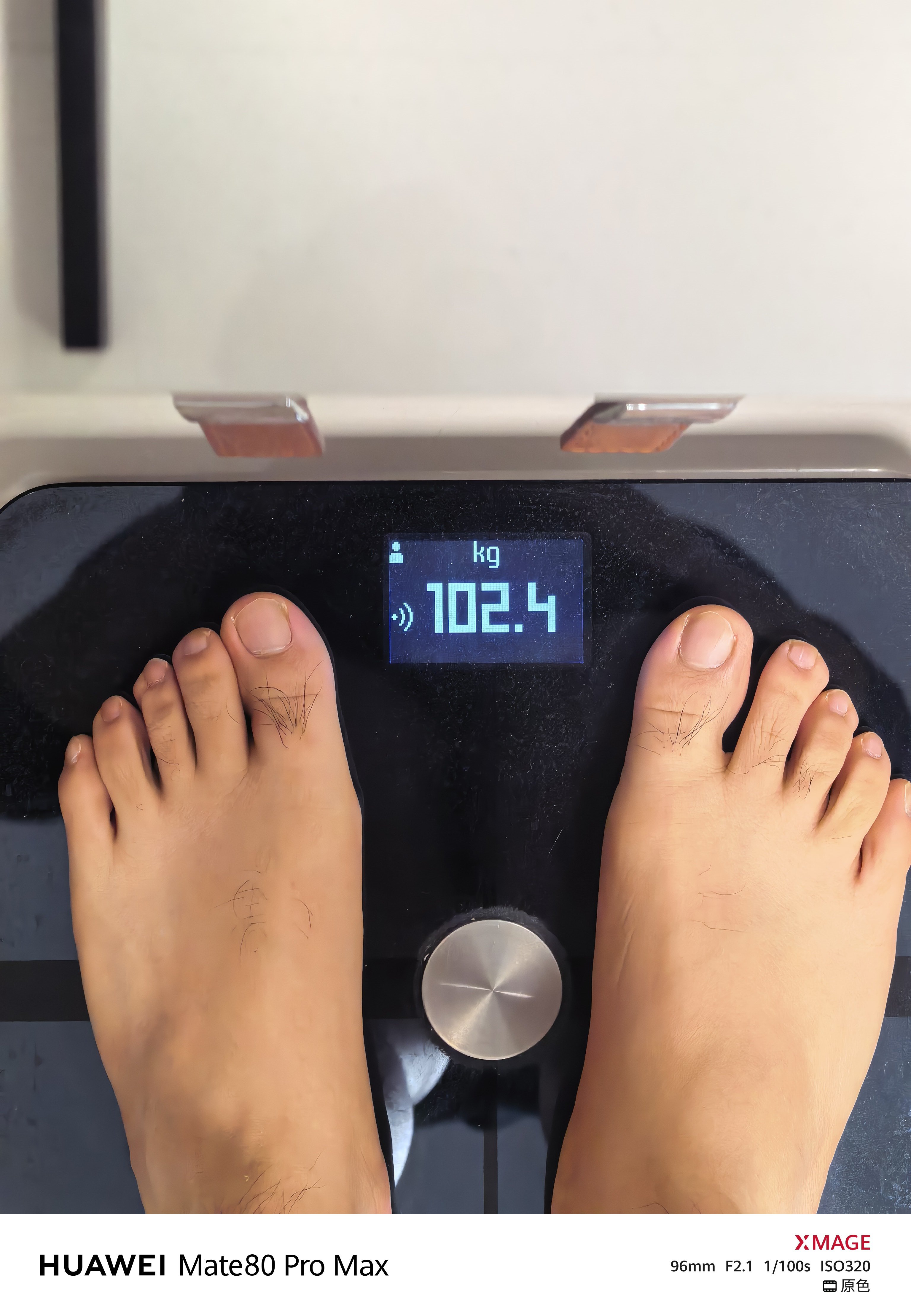 大阳的减重日志 day4：102.4kg 26岁女子两月暴瘦30斤成糖尿病前期 