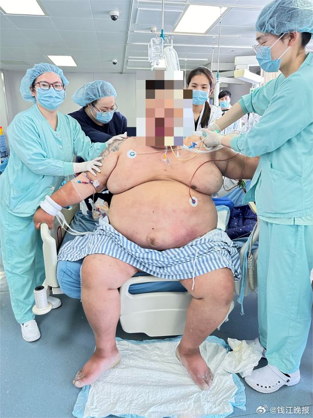 #410斤男子胖到呼吸困难险窒息#【胖到无法呼吸！410斤男子72小时“窒息生死