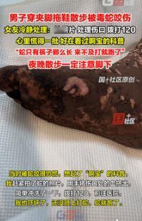 遇到贵人了！9月15日重庆，一男子穿拖鞋散步时，不慎被毒蛇给咬伤，没有应对经验的