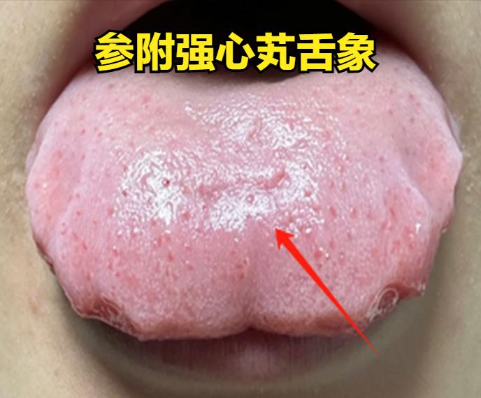 腿凉“找脾”，腰凉“找肾”，背凉“找心”，一个中成药 暖脾 暖肾 暖心

1、腿
